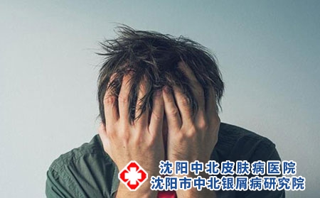 牛皮癣是否传染?应该如何护理?