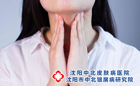 精神因素是牛皮癣的病因吗?如何保健护理?