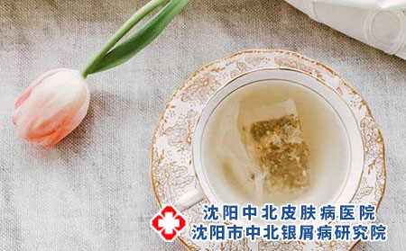 背部牛皮癣应该如何护理?牛皮癣传染吗?