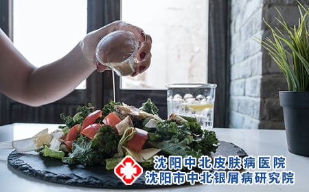 牛皮癣吃什么比较好?补充维生素吗?