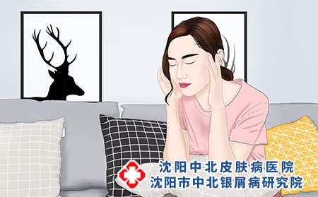 女性在生理期时银屑病会加重吗?为什么?如何治疗呢?