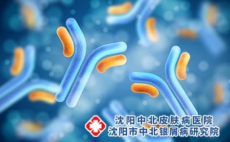 治银屑病用蒲公英有效果吗