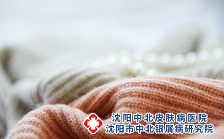 阴雨天银屑病患者应该注意些什么呢