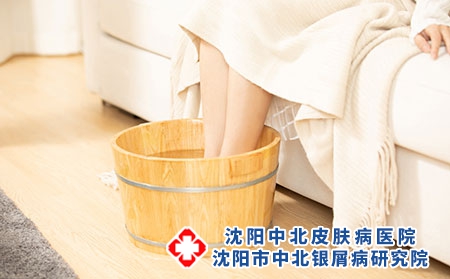 牛皮癣患者在冬季应如何进行护理
