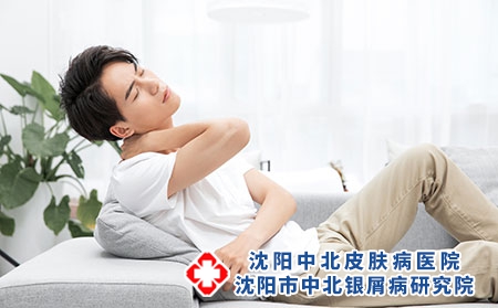 男性患银屑病会遗传吗?遗传几率大吗?