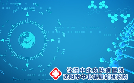 艾灸灸针穴位治疗银屑病有用吗