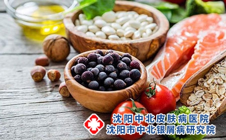 银屑病忌口需要注意什么?