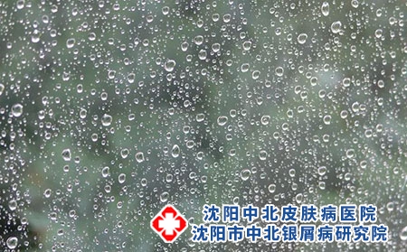 【雨水】春天将至，银屑病注意保养