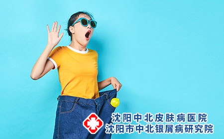 患了银屑病可以给宝宝喂母乳吗