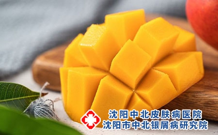 身上的牛皮癣可以治好吗