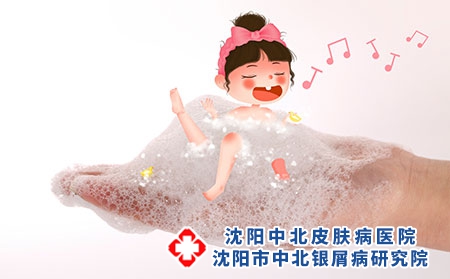 孩子头上出现牛皮癣有什么治疗好方法吗