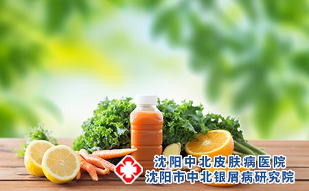 银屑病日常生活中的禁忌有哪些?
