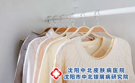 牛皮癣一般会有什么症状表现呢