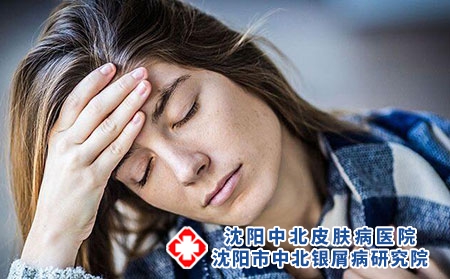 沈阳中北银屑病研究院快递给邮药吗?都什么药不让邮