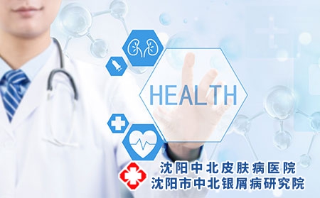 患了牛皮癣要注意什么呢