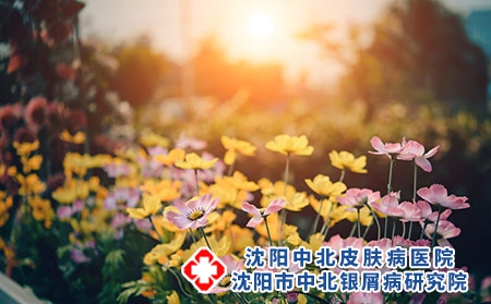 沈阳中北银屑病研究院：顺丰快递能邮药么?