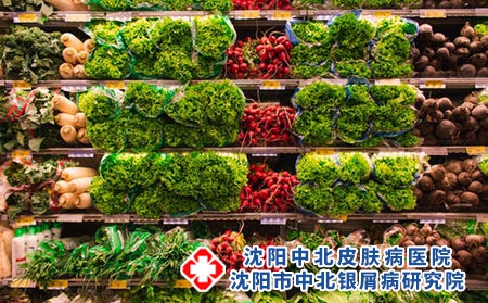 要治疗银屑病应该采取什么措施?