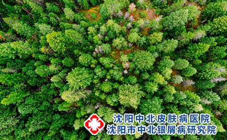 在沈阳治疗银屑病，就选沈阳中北银屑病研究院