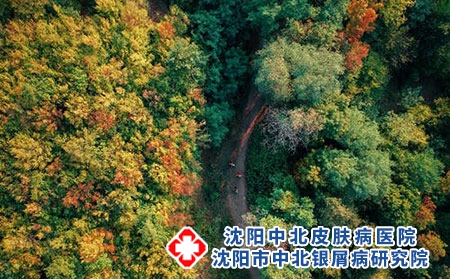 沈阳中北银屑病研究院：顺丰快递现在能邮药吗?