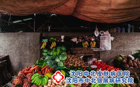 得了银屑病怎么办 如何治疗效果更好些?