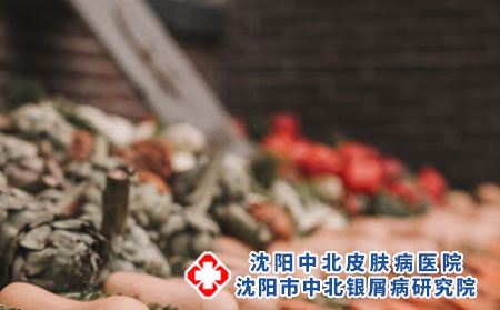 沈阳中北银屑病研究院治疗效果怎么样?