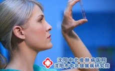 银屑病会扩散吗?