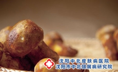 银屑病可以吃菌类食物吗