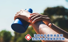 拍打治疗牛皮癣有效吗？