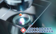 牛皮癣累及脏器需查血常规?