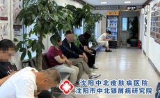 银屑病影响寿命吗 得了这个病还能正常过日子吗