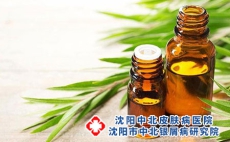 治疗牛皮癣的中药偏方都有哪些？