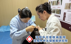 辽宁头屑特别多是牛皮癣吗?沈阳中北孙金奎院长帮你辨别