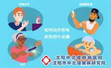 牛皮癣有哪些危害，了解后尽早避免!
