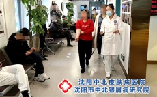 沈阳中北郎冬雪主任：银屑病患者能吃甜食吗