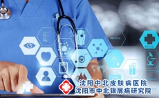 银屑病患者常面临的三大难题，长春银屑病医院