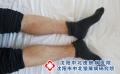 沈阳银屑病的治疗费用 本地就诊花费认知实用指南