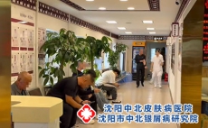 辽宁银屑病本地就诊治银屑病，不用瞎跑