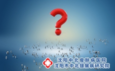 儿童同时患有皮肤过敏和牛皮癣先治哪个比较好呢?