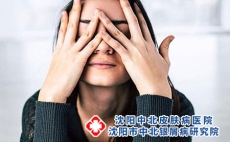 患上牛皮癣要怎么办呢?