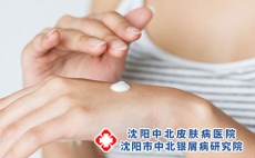 牛皮癣用药过多有什么反应