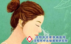 银屑病治好了还会出现瘙痒的问题吗？
