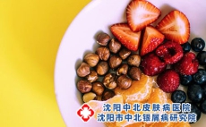 银屑病患者饮食方面需要注意什么