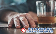 牛皮癣能适量饮酒吗