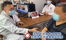 沈阳治疗银屑病好医院在哪?沈阳银屑病研究所地址