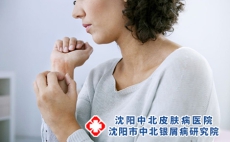 寻常型银屑病，“寻常”背后隐藏着什么?