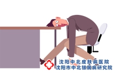 银屑病与疲劳之间的关系?
