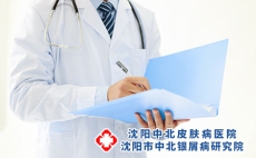 沈阳看银屑病前十公布医院：银屑病诊疗是需要注意什么