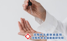 沈阳牛皮癣医院怎么样-牛皮癣较佳的护理方法有哪些?