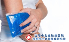 帮助银屑病关节炎患者保持关节温暖?