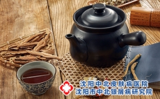 中医治疗牛皮癣的方法